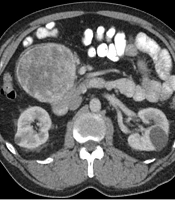 Int J Endocrinol Metab
